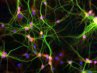 Human Neurons